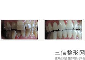 沈阳牙科医院排名前10！ 沈阳米兰口腔医院首次上榜