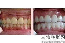 沈阳牙科医院排名前10！ 沈阳米兰口腔医院首次上榜