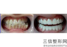 沈阳牙科医院排名前10！ 沈阳米兰口腔医院首次上榜