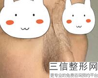 石家庄隆鼻整形医院哪家好！口碑良好