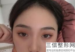 天津近视激光手术医院排名前十！ 天津市眼科医院位列前十