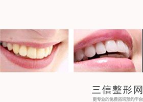 天津口腔医院牙齿矫正整形排行榜！天津市中诺口腔医院入围