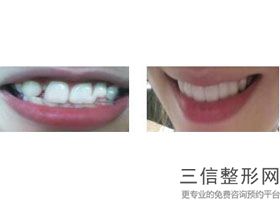 天津牙齿整形医院排名榜前五！不容错过