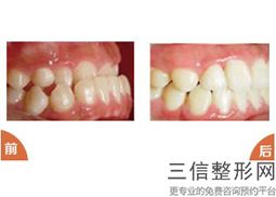 天津牙科医院排名前10！天津市第四中心医院口腔科排名靠前