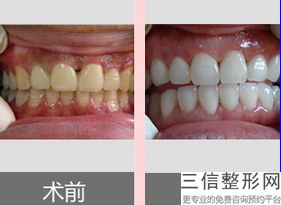 温州口腔医院排行榜前五横评！不容错过