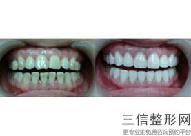 温州牙科医院排名！实力入围