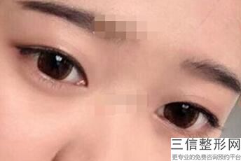 无锡去眼袋整形医院排名前十！无锡瀚晨医疗美容门诊部排名靠前