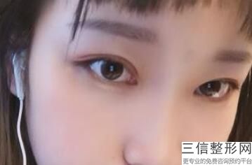 无锡去眼袋整形医院排名前十！无锡瀚晨医疗美容门诊部排名靠前