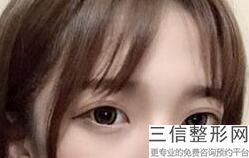 无锡去眼袋整形医院排名前十！无锡瀚晨医疗美容门诊部排名靠前