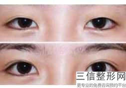 无锡去眼袋整形医院排名前十！无锡瀚晨医疗美容门诊部排名靠前