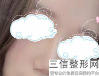 西安鼻子整形医院排名前十！西安美人鱼医疗美容机构位列前十