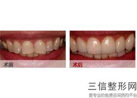 西安口腔医院排名榜！陕西省人民医院口腔科口碑良好
