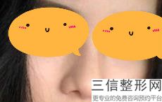 西安隆鼻整形医院排行前十！西安伊美尔医学美容门诊部锁定前十