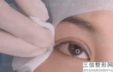 西安双眼皮医院排名前十！西安瑞美佳人医疗美容门诊部位列前十