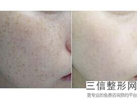 西安做拉皮手术医院排名前十！西安高一生医疗整形美容医院不容错过