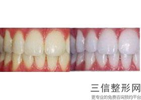 盐城牙科医院排名前五！盐城鼎植口腔医院遥遥领先
