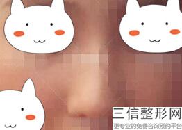 郑州隆鼻医院排名前十！郑州壹加壹美容整形机构遥遥领先