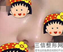 郑州隆鼻医院排名前十！郑州壹加壹美容整形机构遥遥领先
