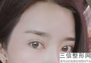 郑州眼部整形医生排名前六已出示！张栋益实力非凡