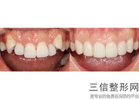 中山口腔医院排名榜前八强名单锁定！ 中山市爱雅口腔医院实力非凡