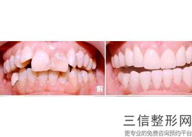中山口腔医院排名榜前五强实名推荐！中山爱思特口腔医院实力上榜