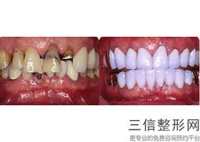 重庆口腔医院排名前十摆谈！重庆瑞泰口腔医院锁定前十