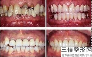 重庆口腔医院排名前十摆谈！重庆瑞泰口腔医院锁定前十