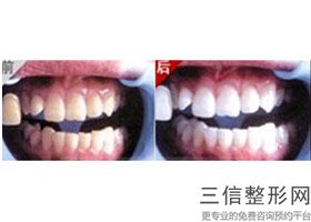 重庆牙科医院排名!重庆团圆口腔医院团圆口腔医院成立于2018年