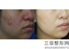 北京八大处拉皮手术专家排名榜top4实力评出,北京拉皮手术医院排名