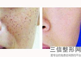 北京八大处拉皮手术专家排名榜top4实力评出,北京拉皮手术医院排名
