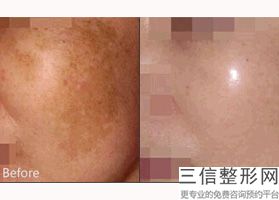 北京八大处拉皮手术专家排名榜top4实力评出,北京拉皮手术医院排名