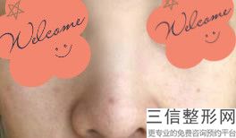 北京鼻部整形医院哪个好,北京比较好的医院