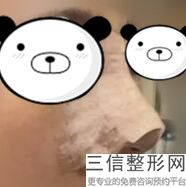 北京鼻部整形医院哪个好,北京比较好的医院