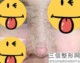 北京鼻部整形医院排行榜前五名单公布,鼻子整形医院排名