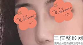 北京鼻部整形医院排行榜前五名单公布,鼻子整形医院排名