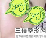 北京鼻部整形医院排行榜前五名单公布,鼻子整形医院排名