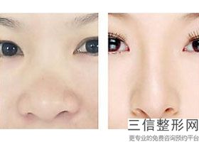 北京鼻子修复医院排行榜前三权威发布,鼻子修复良好的医院