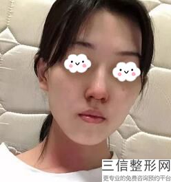 北京鼻子修复医院排行榜前三权威发布,鼻子修复良好的医院