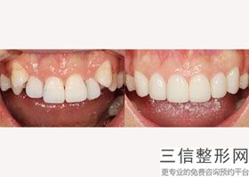 北京成人牙齿整形医院排名榜十强揭晓,北京牙齿矫正医院排行