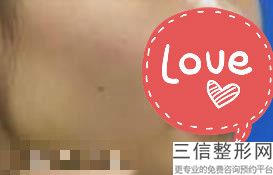 北京唇部整形医院十佳排名榜全新汇总,北京嘴唇整形医院哪家好