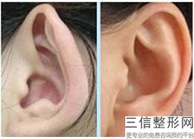 北京耳朵整形医院排行榜前十公立版,全国良好的整形医院