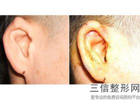 北京耳朵整形医院排行榜前十公立版,全国良好的整形医院