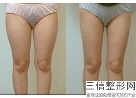 北京丰胸医院排名前十口碑实力汇总盘点,哪家丰胸医院好