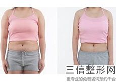 北京丰胸医院排名前十口碑实力汇总盘点,哪家丰胸医院好