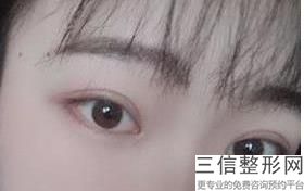 北京近视眼手术医院排名前十,北京医院近视眼手术哪家好