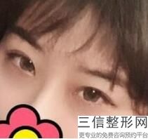 北京近视眼手术医院排名前十,北京医院近视眼手术哪家好