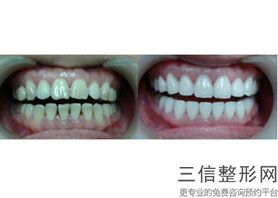 北京口腔公立医院前十排名权威发布,北京十大公立口腔医院排名