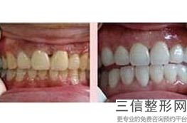 北京口腔公立医院前十排名权威发布,北京十大公立口腔医院排名