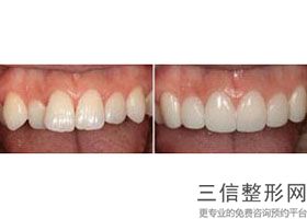 北京口腔公立医院前十排名权威发布,北京十大公立口腔医院排名