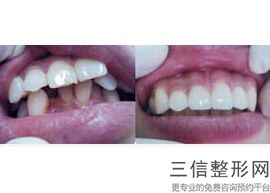 北京口腔科医院排名榜,北京口腔科排名